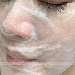 Sữa Rửa Mặt Floslek Anti Acne Face Cleansing Gel Dành Cho Da Dầu Mụn 200ml