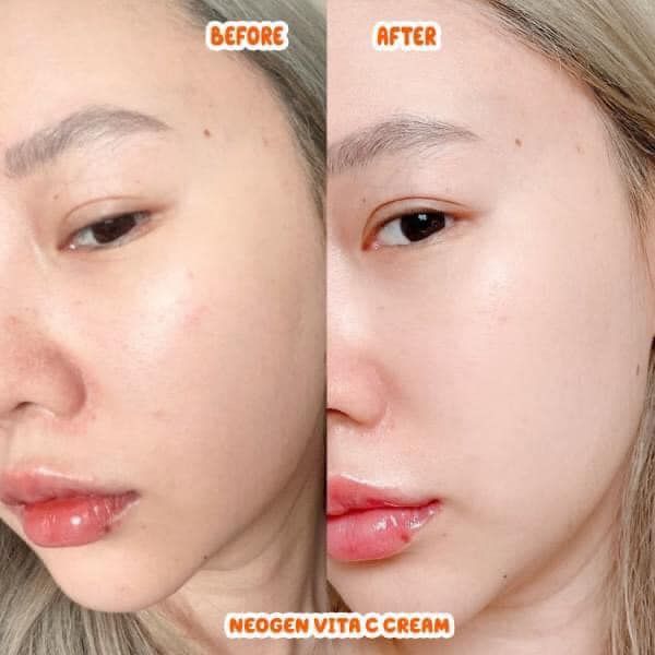 Tinh Chất Neogen Real Vita C Serum 22% + 5%  Dưỡng Trắng, Mờ Thâm 32g (Mẫu Mới)