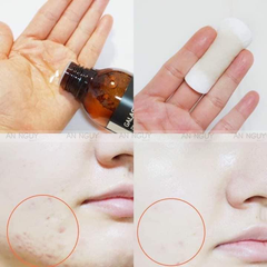 Nước Hoa Hồng Some By Mi Galactomyces Pure Vitamin C Glow Toner Dưỡng Sáng, Ngừa Lão Hóa 200ml