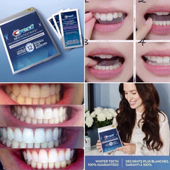 Miếng Dán Trắng Răng Crest 3D Whitestrips Professional Effects Levels 12 Whiter