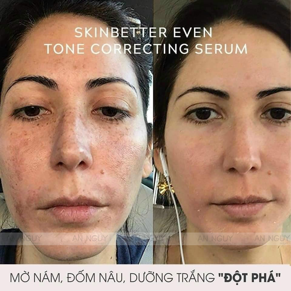 Tinh Chất Làm Giảm Nám, Sáng Da SkinBetter Science Even Tone Correcting Serum 50ml