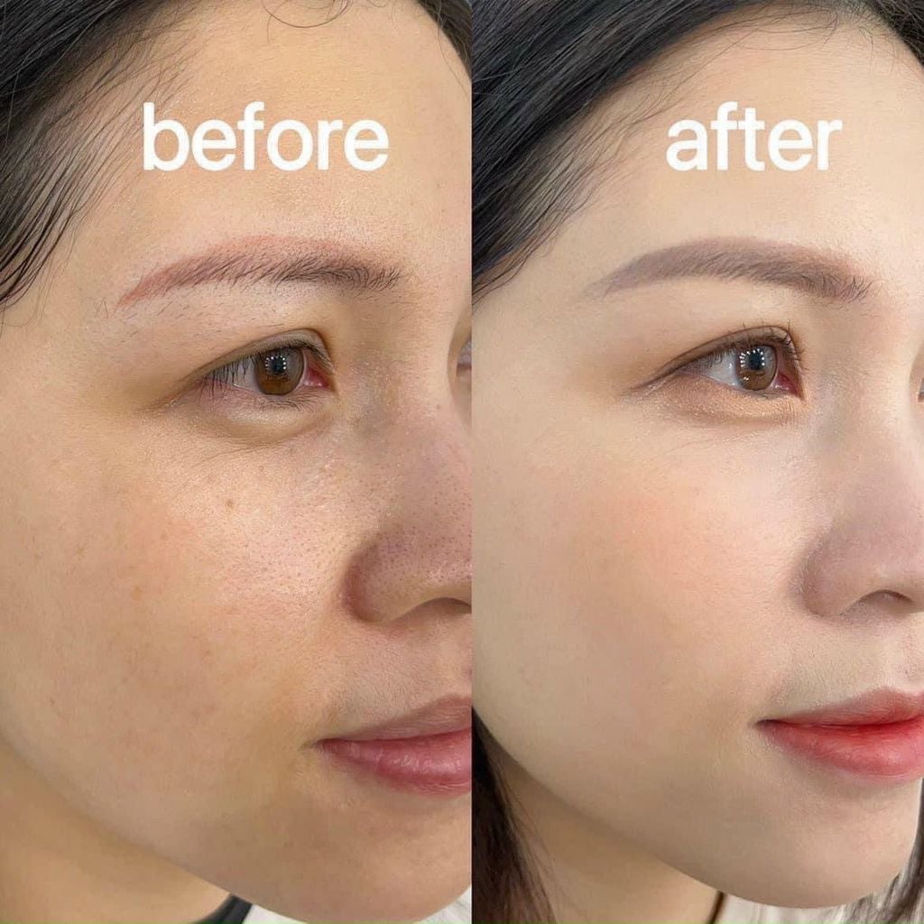 Kem Dưỡng Zo Skin Health Daily Power Defense Phục Hồi Da 30ml