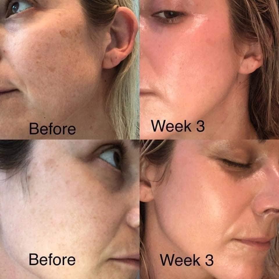 Kem Dưỡng Zo Skin Health Retinol Skin Brightener Sáng Da 1% Phục Hồi Và Cải Thiện Da