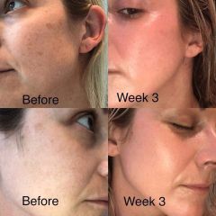 Kem Dưỡng Zo Skin Health Retinol Skin Brightener Sáng Da 1% Phục Hồi Và Cải Thiện Da