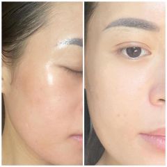 Tinh Chất SkinClinic P.R.P Tái Tạo Và Trẻ Hóa Tế Bào Gốc 30ml