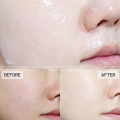 Mặt Nạ Dưỡng Da Naruko Mask Chăm Sóc Mọi Loại Da
