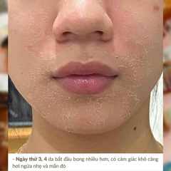 Tinh Chất Thay Da Sinh Học NeoStrata Prosystem Retinol Peel (Ống 1.5ml)