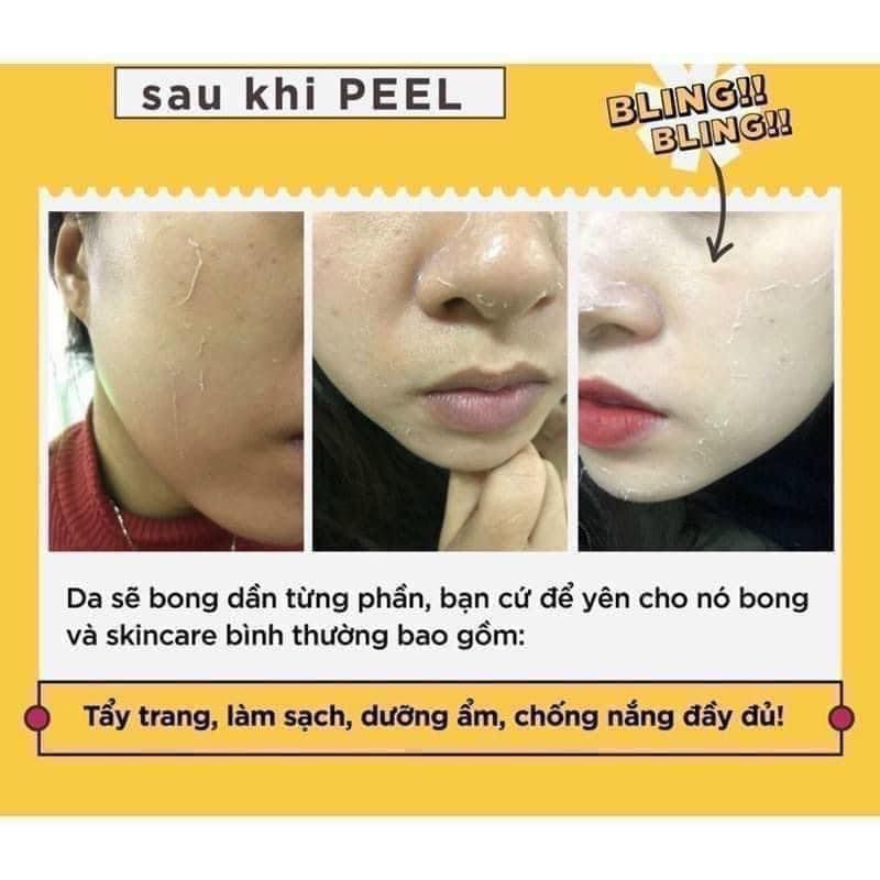 Tinh Chất Thay Da Sinh Học NeoStrata Prosystem Retinol Peel (Ống 1.5ml)