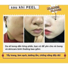 Tinh Chất Thay Da Sinh Học NeoStrata Prosystem Retinol Peel (Ống 1.5ml)