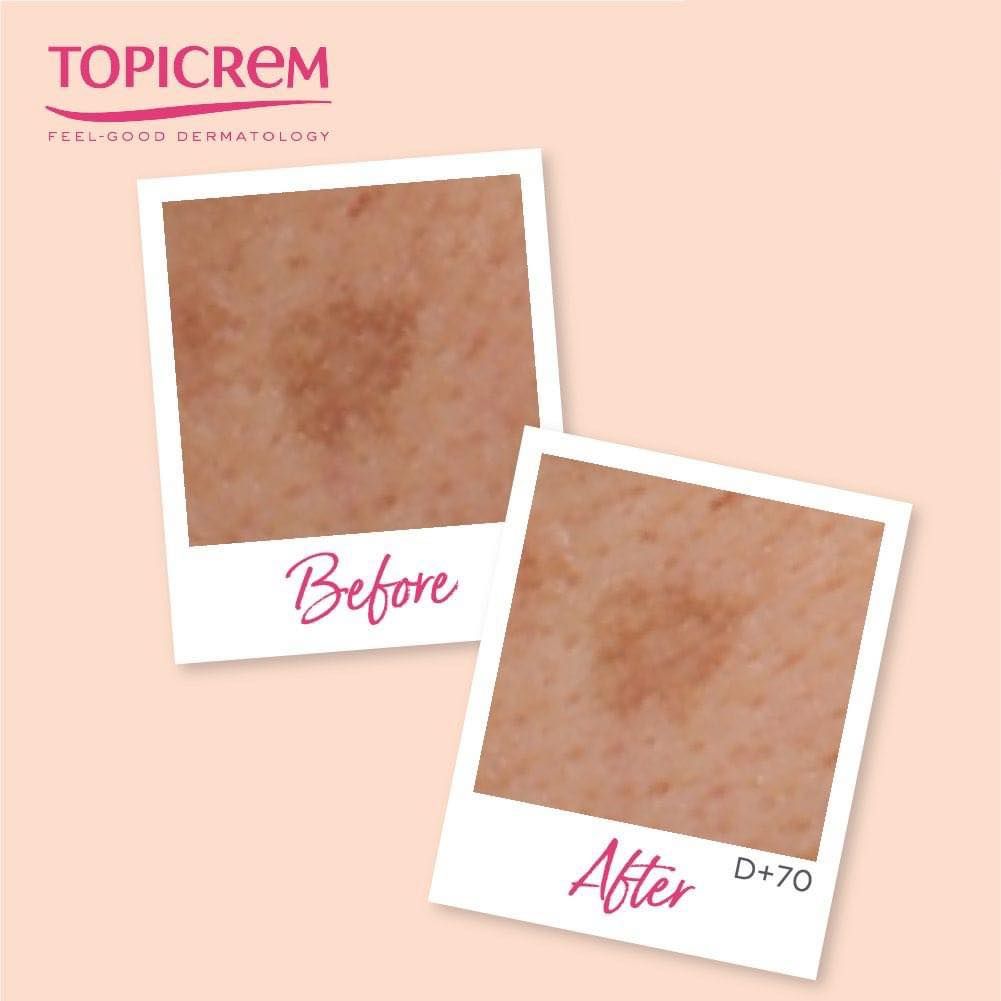 Tinh Chất Topicrem MELA Booster Serum Giảm Thâm Nám 30ml