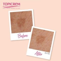 Tinh Chất Topicrem MELA Booster Serum Giảm Thâm Nám 30ml