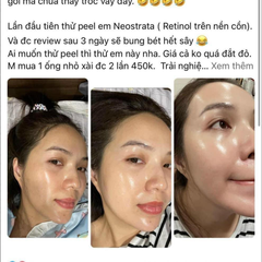 Tinh Chất Thay Da Sinh Học NeoStrata Prosystem Retinol Peel (Ống 1.5ml)