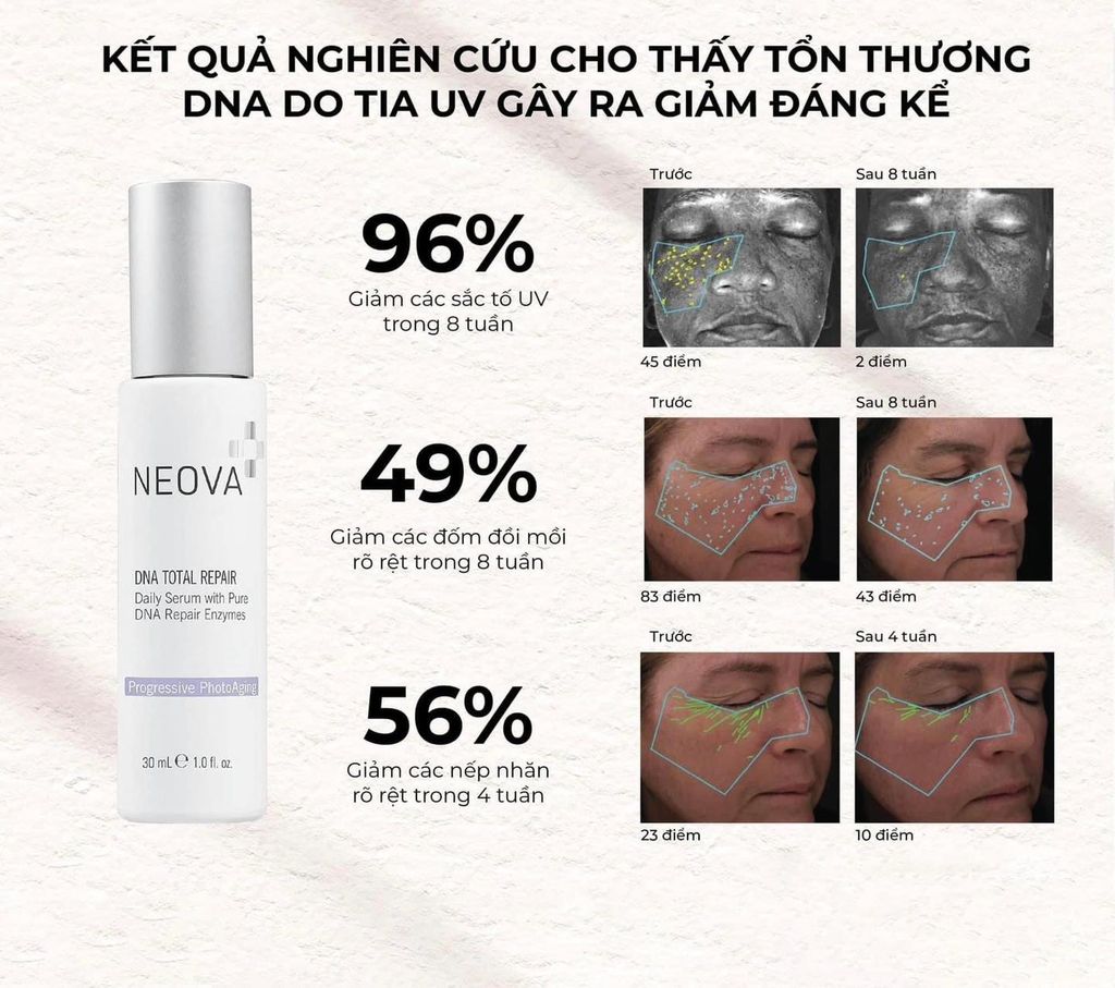 Serum Dưỡng Da Neova Enzymes DNA Total Repair Tinh Khiết Chống Oxy Hóa 30ml