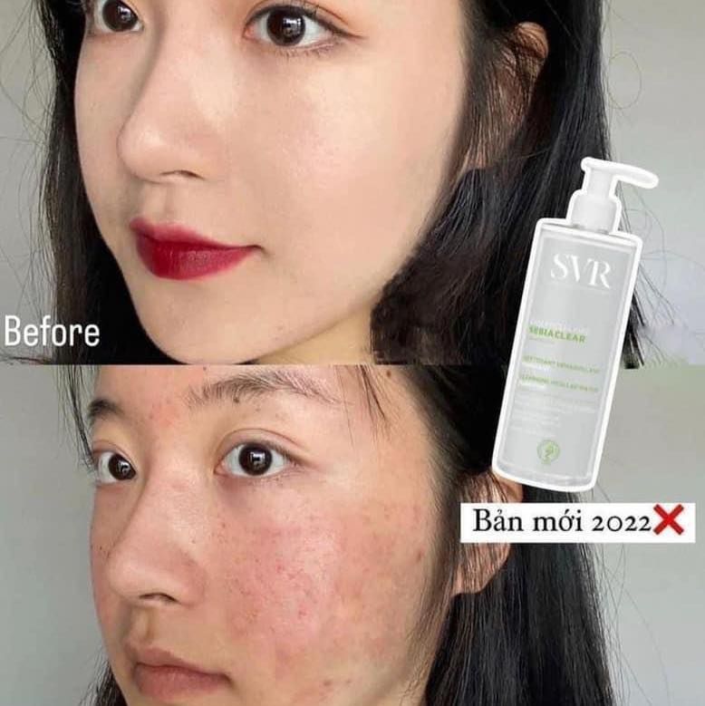 Nước Tẩy Trang SVR Sebiaclear Eau Micellaire Dành Cho Da Dầu