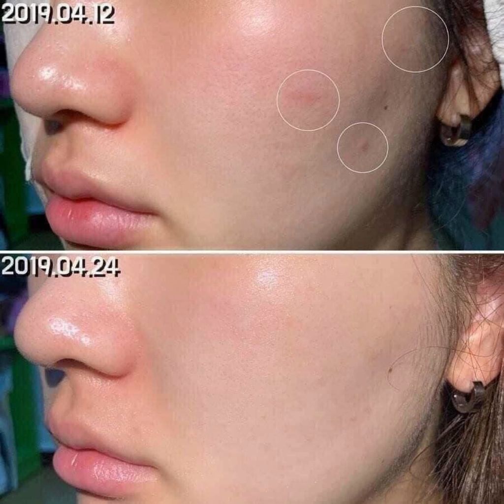 Combo Kem Dưỡng Phục Hồi Da Bioderma Cicabio Creme 40ml Và Nước Tẩy Trang Bioderma Sensibio H2O Cho Da Nhạy Cảm 100ml