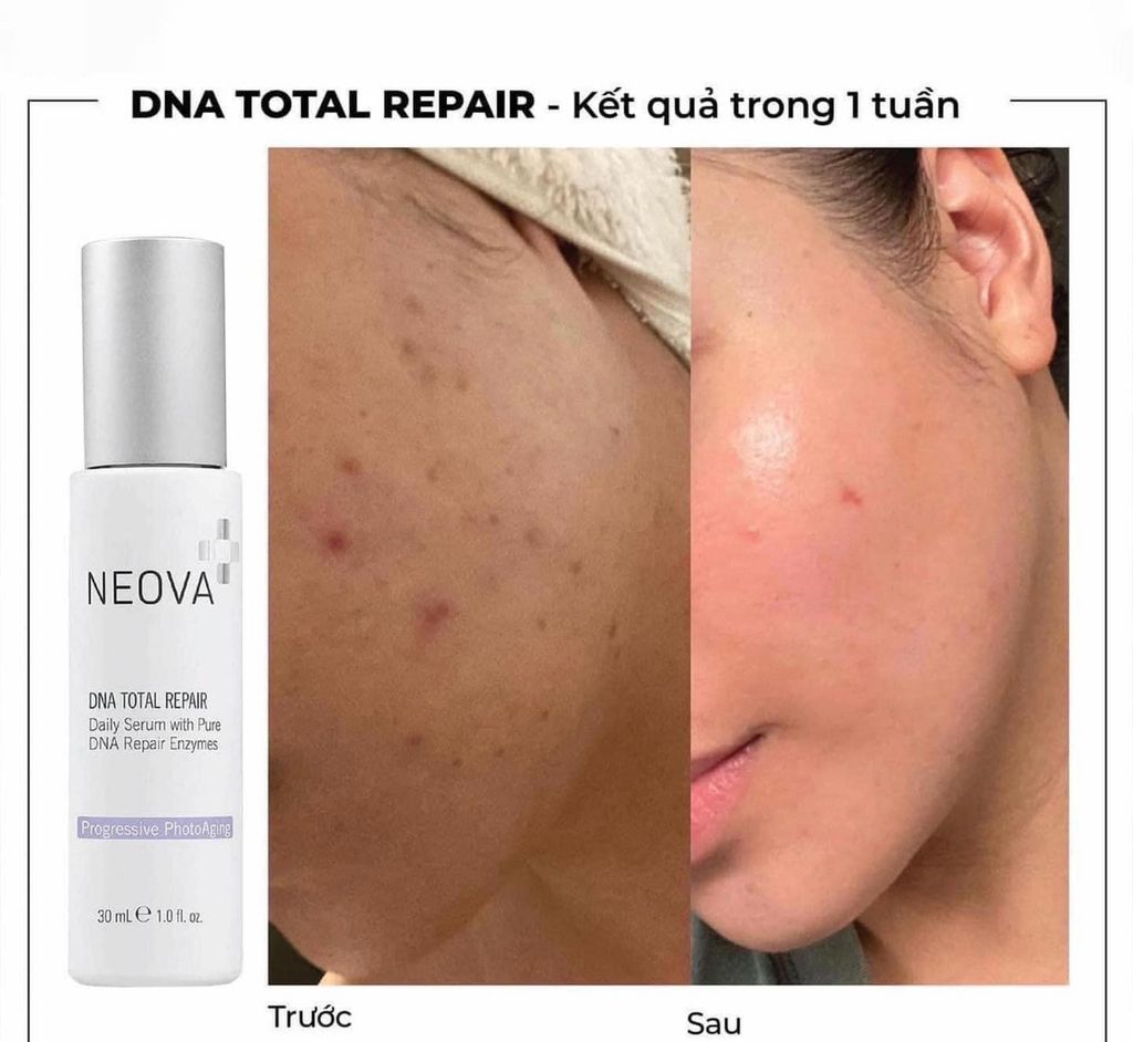 Serum Dưỡng Da Neova Enzymes DNA Total Repair Tinh Khiết Chống Oxy Hóa 30ml