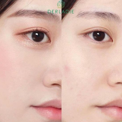 Nước Tẩy Trang Derladie Cleansing Water Witch Hazel Micellar Unscented Sạch Sâu 500ml