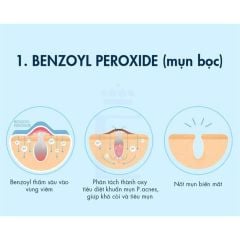 Kem Trị Mụn Benzac AC5 5% Benzoyl Preoxide 15gr