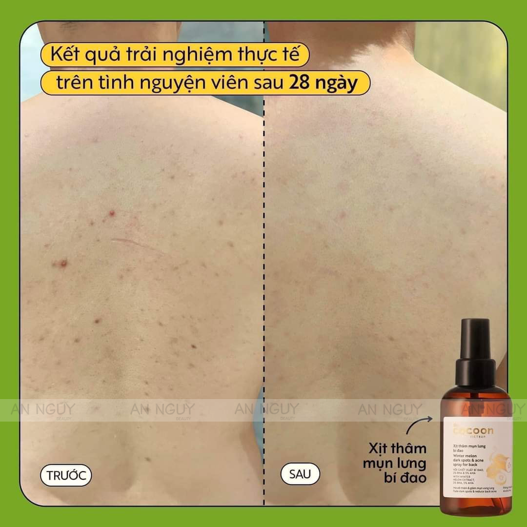 Xịt Thâm Mụn Lưng Cocoon Winter Melon Dark Spots & Acne Spray For Back Chiết Xuất Bí Đao 140ml