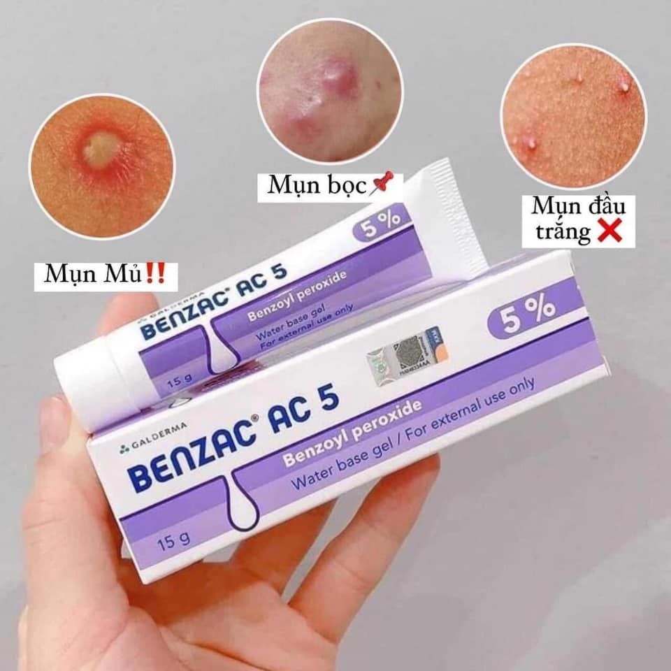 Kem Trị Mụn Benzac AC5 5% Benzoyl Preoxide 15gr