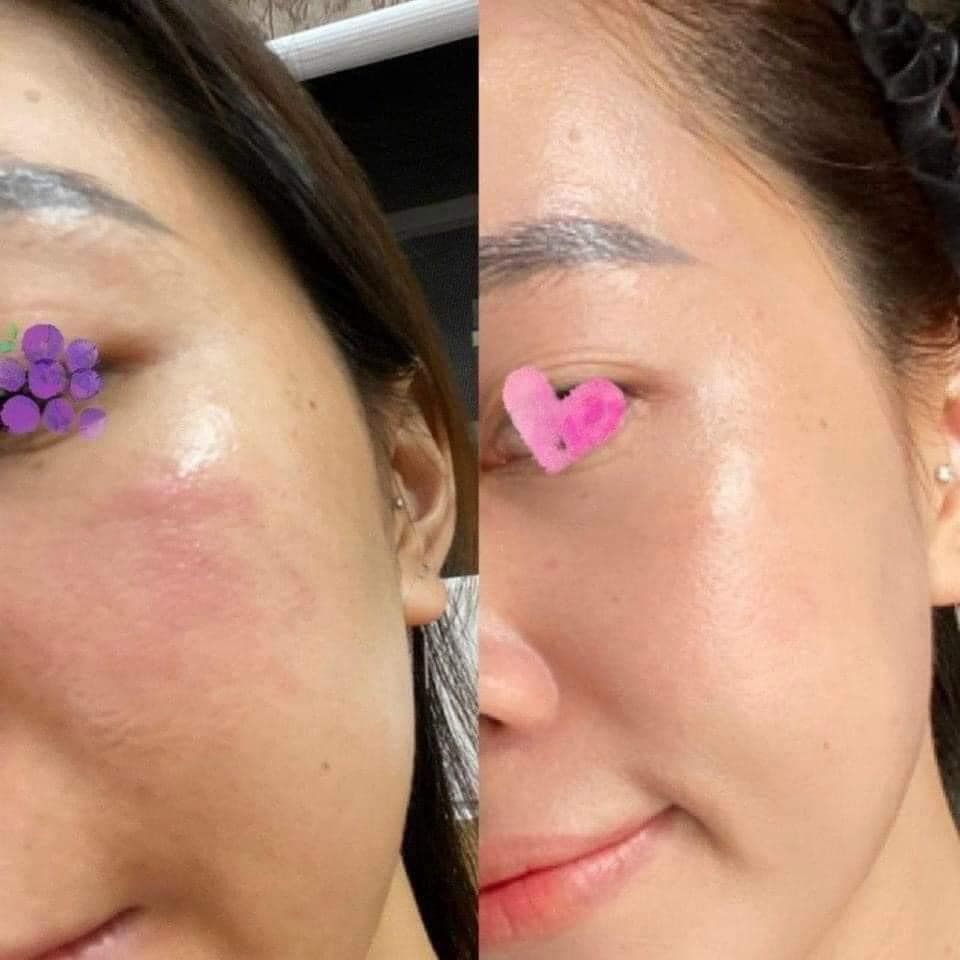 Kem Dưỡng Teoxane Deep Repair Balm Phục Hồi Cho Da Nhạy Cảm 30ml