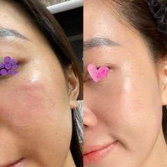 Kem Dưỡng Teoxane Deep Repair Balm Phục Hồi Cho Da Nhạy Cảm 30ml