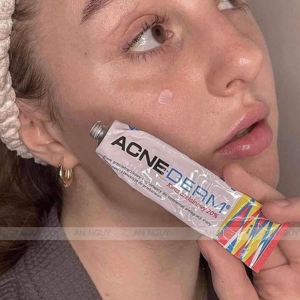 Kem Trị Mụn, Mờ Thâm Acne Derm Kwas Azelainowy 20% 20gr