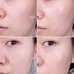 Kem Dưỡng Trắng Da Estee Lauder Revitalizing Supreme + Bright Ngăn Ngừa Lão Hóa Da