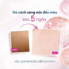 Kem Ngăn Mùi Dove Deodorant Dry Serum 3% Niacinamide Dưỡng Sáng, Đều Màu 40ml