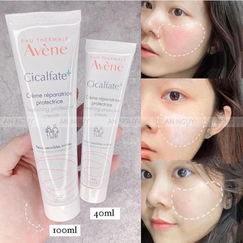 Kem Dưỡng Avène Cicalfate+ Repair Cream Hỗ Trợ Làm Lành, Phục Hồi Da