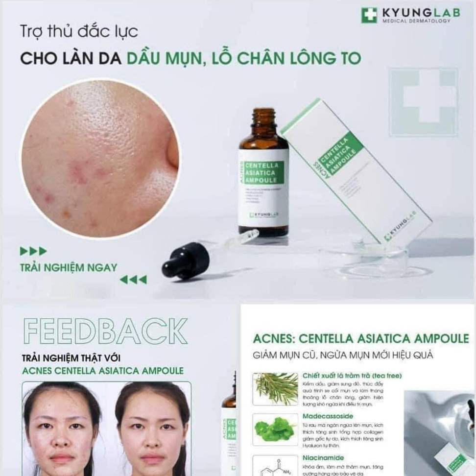 Tinh Chất Kyung Lab Acnes Centella Asiatica Ampoule Giảm Mụn 50ml