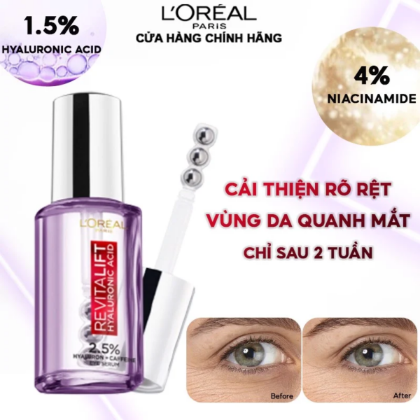 Serum Mắt L’Oreal Revitalift 2.5% Hyaluronic Acid + Caffeine Eye Serum Giảm Bọng Mắt & Làm Đầy Rãnh Nhăn 20ml