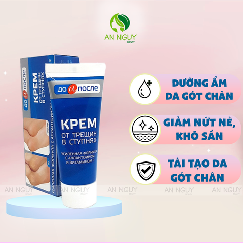 Kem Trị Nứt Gót Chân KPEM 50ml