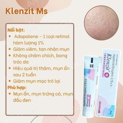 Gel Trị Mụn Glenmark Klenzit MS Aqueous Gel Dành Cho Da Bị Mụn Ẩn, Mụn Đầu Đen 15gr