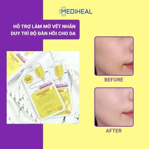 Mặt Nạ Dưỡng Da Mediheal Essential Mask EX 25ml