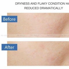 [Minisize] Sữa Rửa Mặt CeraVe Cho Da Thường Đến Khô Hydrating Cleanser