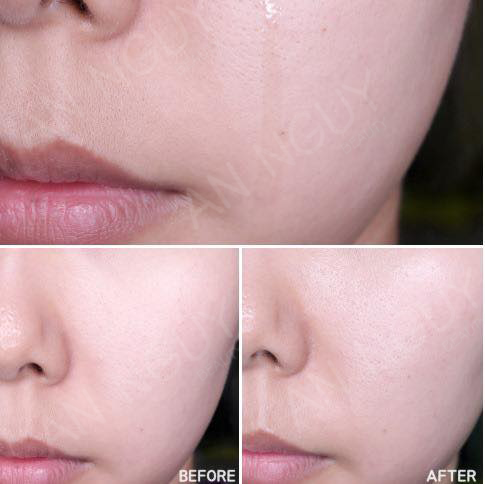 Tinh Chất Trị Mụn Some By Mi AHA-BHA-PHA 30 Days Miracle Serum 50ml