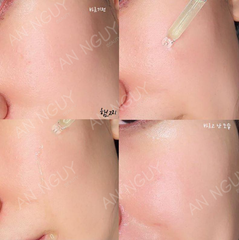 Tinh Chất Trị Mụn Some By Mi AHA-BHA-PHA 30 Days Miracle Serum 50ml