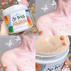 Tẩy Tế Bào Chết Toàn Thân St.Ives Blemish Control Apricot Scrub Hương Mơ 283gr