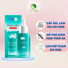 Tinh Chất Hada Labo Acne Care Soothe & Improve Acne-Prone Skin Calming Serum Làm Dịu Da Mụn 30ml