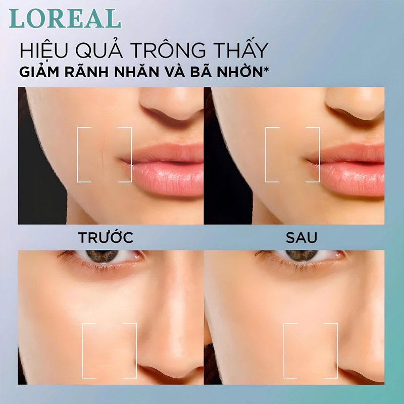 Kem Dưỡng L'Oreal Revitalift Hyaluronic Acid 8H Oil Control Gel Cream Cấp Ẩm, Kiềm Dầu 15ml