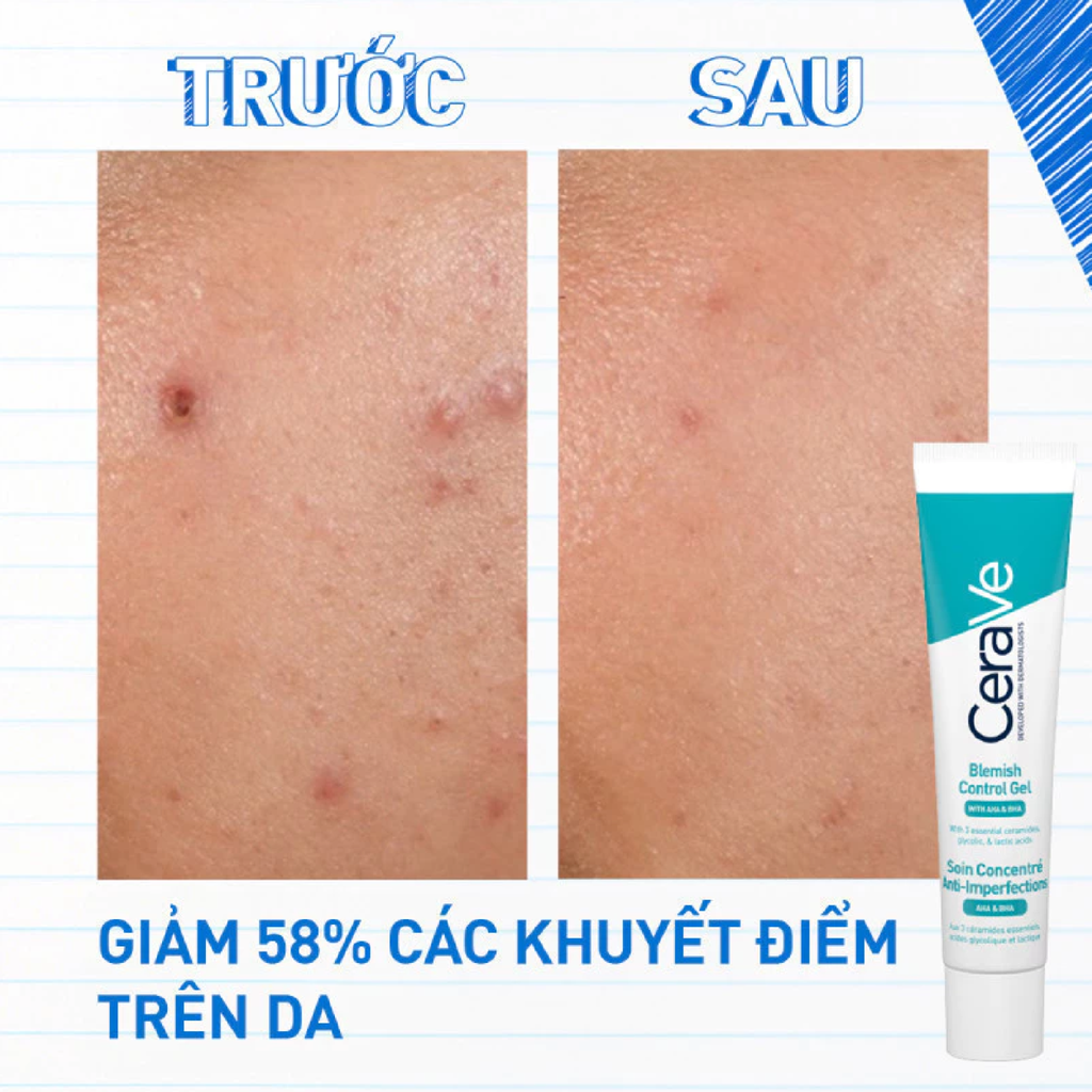 Gel Giảm Mụn CeraVe Blemish Control Gel With AHA & BHA 40ml