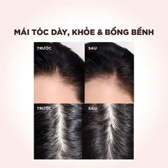 Dầu Xả L'Oreal Paris Full Resist Detangling Conditioner Giảm Rụng Tóc 440ml