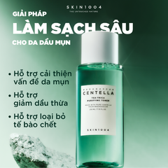 Nước Hoa Hồng Skin1004 Tea-Trica Purifying Toner Dịu Da, Kiểm Soát Dầu 210ml