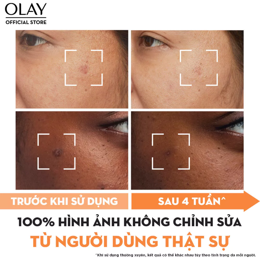 Kem Dưỡng Olay Luminous Moisturiser 50g