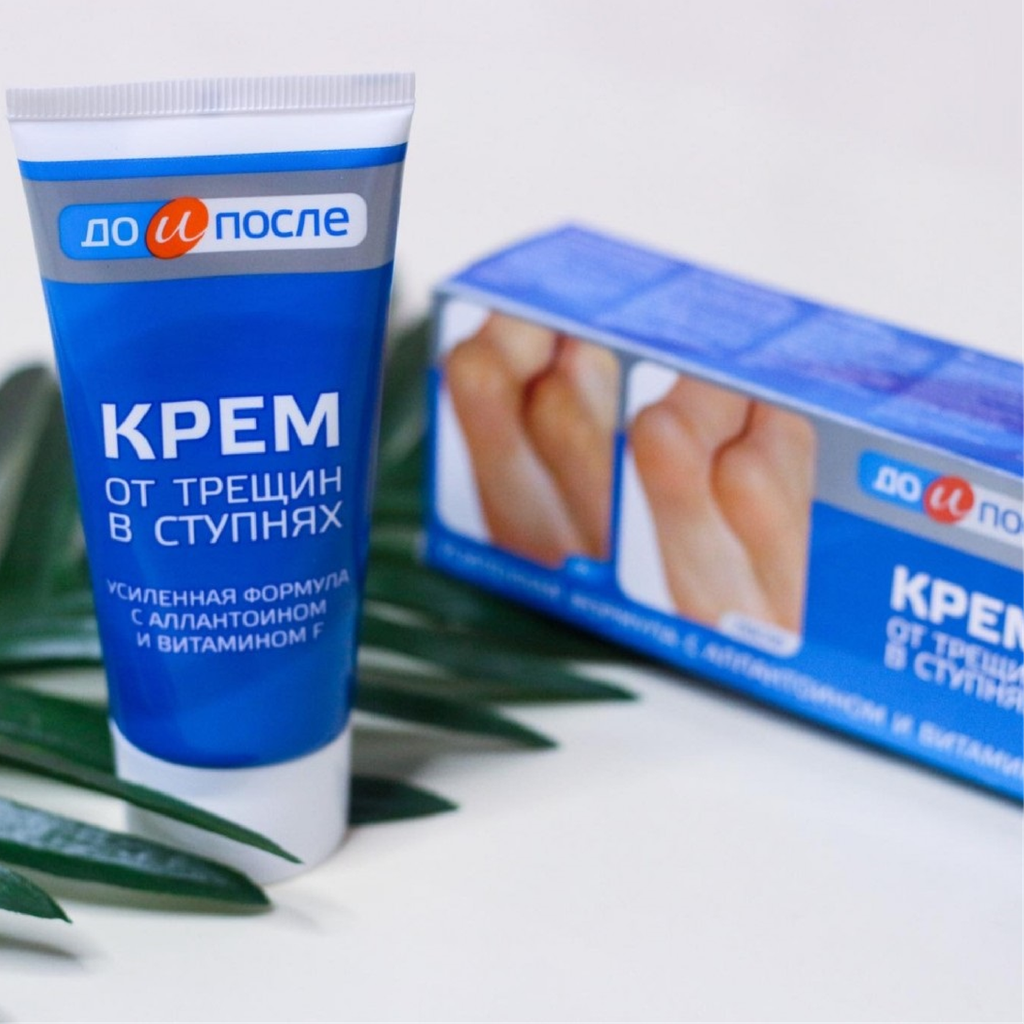 Kem Trị Nứt Gót Chân KPEM 50ml