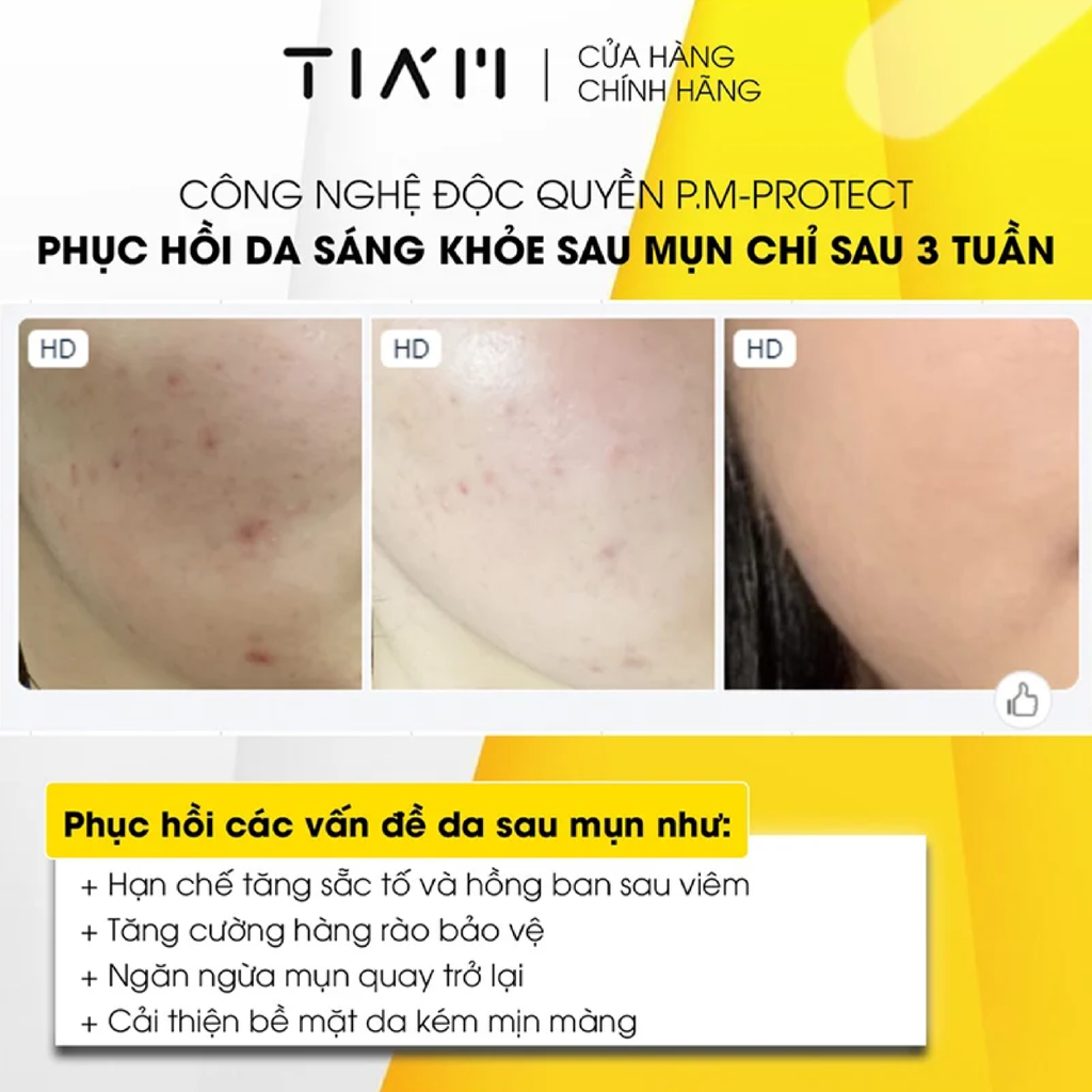 Tinh Chất Tia'm Vita B3 Source Serum Làm Sáng, Phục Hồi Da Sau Mụn