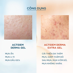 Gel Giảm Mụn Actidem Derma Extra Gel 18g