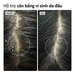 Nước Dưỡng Da Đầu Cocoon Gleditsia Scalp Tonic Chiết Xuất Bồ Kết, Giảm Gàu 140ml