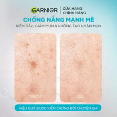 Serum Chống Nắng Garnier Super UV Anti - Acne Serum Sunscreen SPF50+ PA++++ Kiềm Dầu, Giảm Mụn 30ml